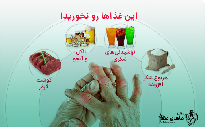 برای نقرس چی بخوریم