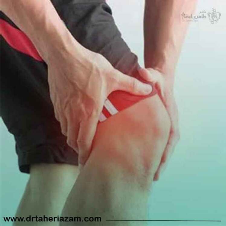 راه های جلوگیری از آرتروز زانو