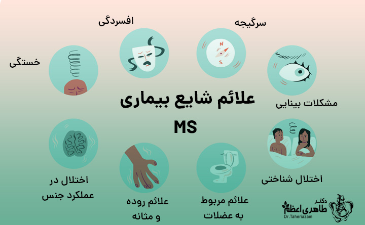 علائم ام اس