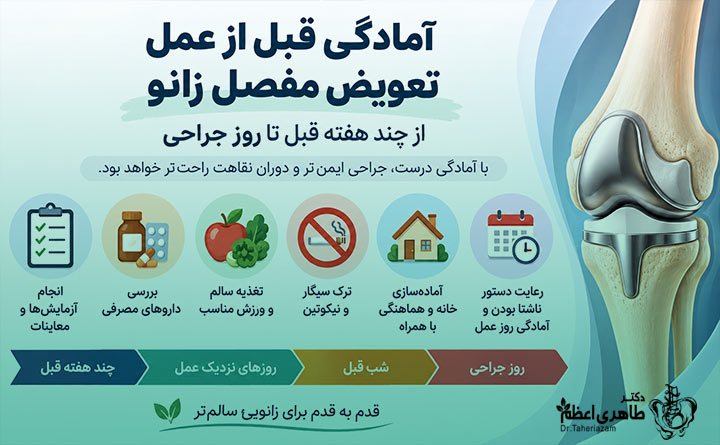 آمادگی های قبل از جراحی تعویض مفصل زانو