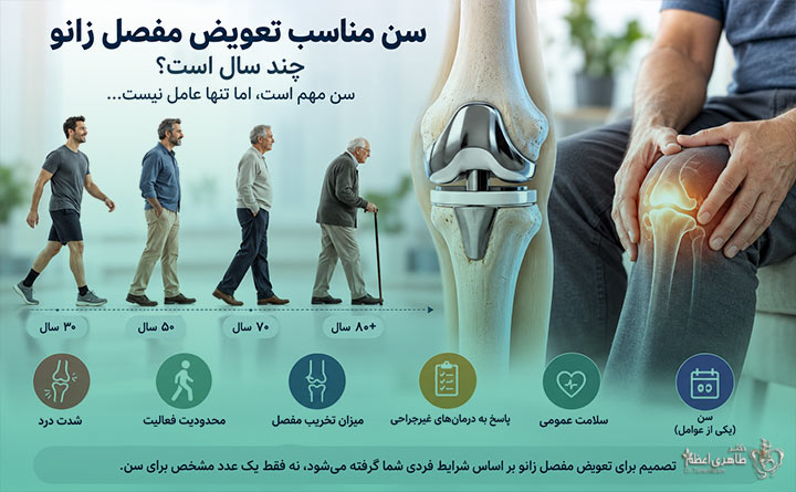 مناسب ترین سن برای تعویض مفصل زانو