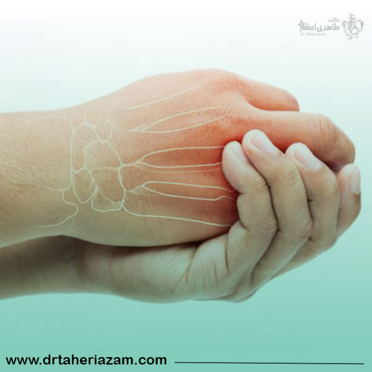 خواب رفتن دست و پا، بررسی علل و راه های درمان