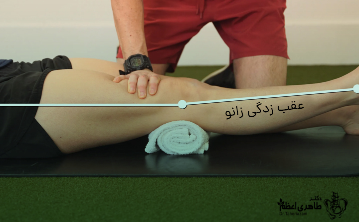 درمان عقب زدگی زانو