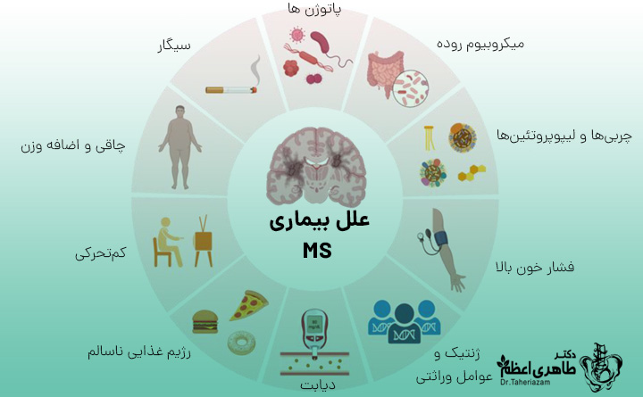 علل بیماری ام اس