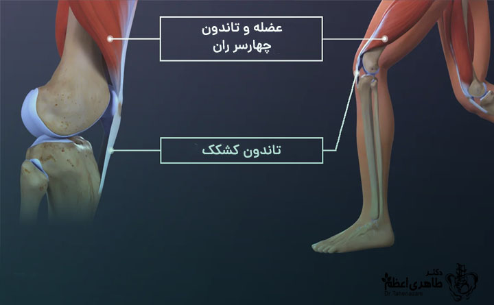 دلیل آسیب به تاندون زانو