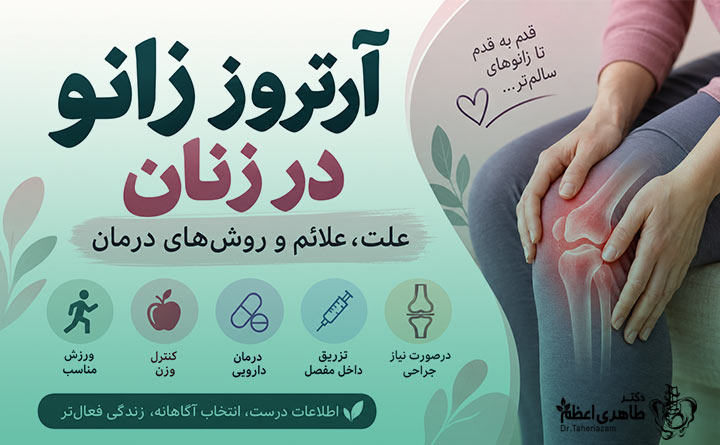 درمان آرتروز زانو در زنان