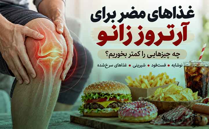 آشنایی با غذاهای مضر برای آرتروز زانو