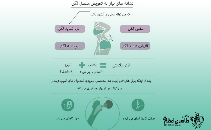 چرا باید عمل تعویض لگن انجام دهیم؟