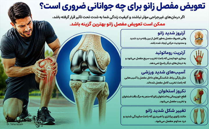 تعویض مفصل زانو برای جوانان