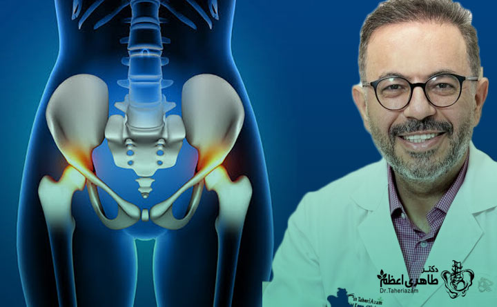 دکتر طاهری اعظم، بهترین دکتر تعویض مفصل لگن