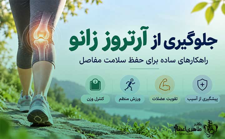 پیشگیری از آرتروز زانو