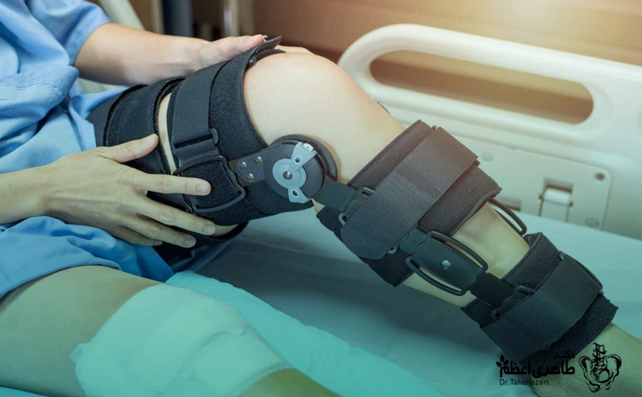 استفاده از زانوبند برای رباط صلیبی