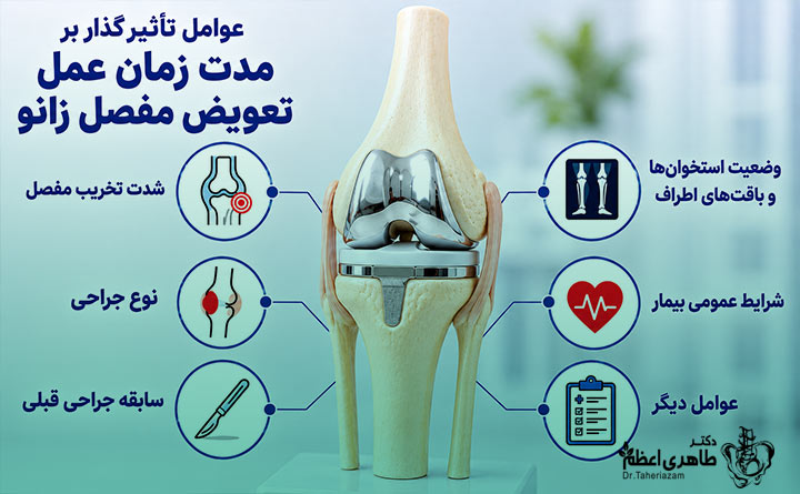 عوامل تأثیرگذار بر مدت زمان عمل تعویض مفصل زانو