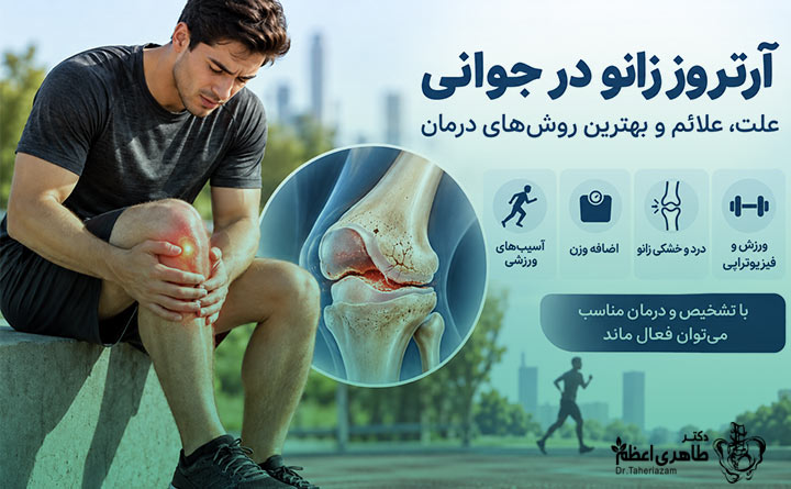 علت آرتروز زانو در جوانی