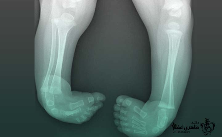 علائم پاچنبری