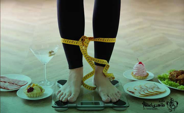 کاهش وزن برای آرتروز زانو