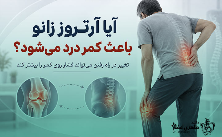 ارتباط زانو درد و کمر درد