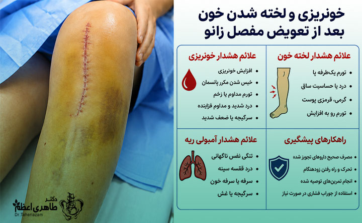 خون ریزی بعد از لخته شدن خون