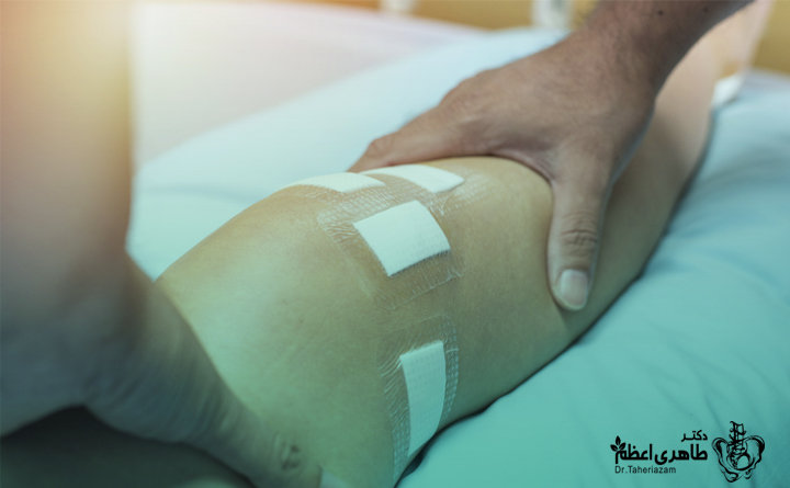 جراحی بازسازی رباط صلیبی