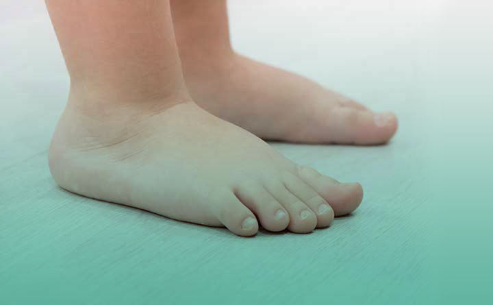 ناهنجاری های مادرزادی