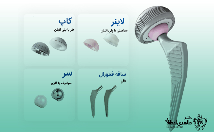 ایمپلنت‌های جدید