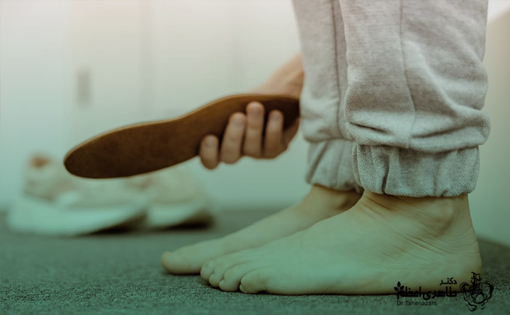 درمان کف پای صاف