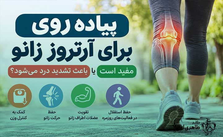 پیاده روی برای درمان آرتروز زانو 