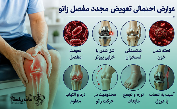 عوارض احتمالی تعویض مجدد مفصل زانو