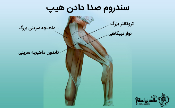 سندرم هیپ صدادار