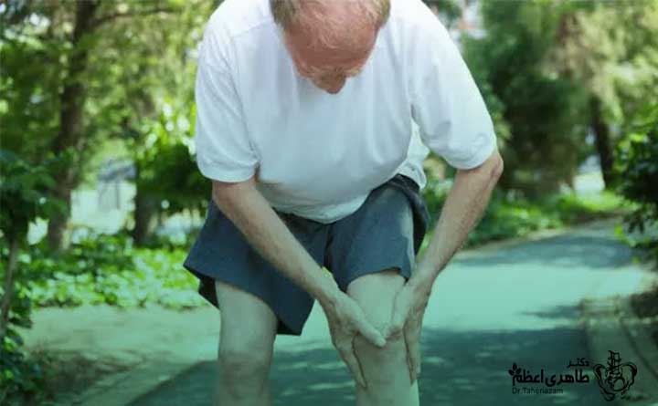 بهترین روش پیاده روی برای آرتروز زانو 