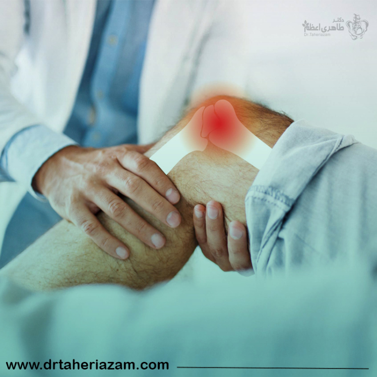 درمان زانو درد فوری + درمان زانو درد شدید در خانه (8 روش خانگی و سریع)