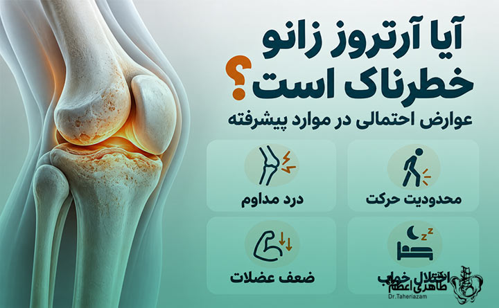 خطرات آرتروز زانو