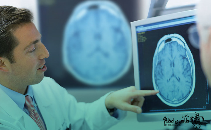 داروهای مناسب برای ms