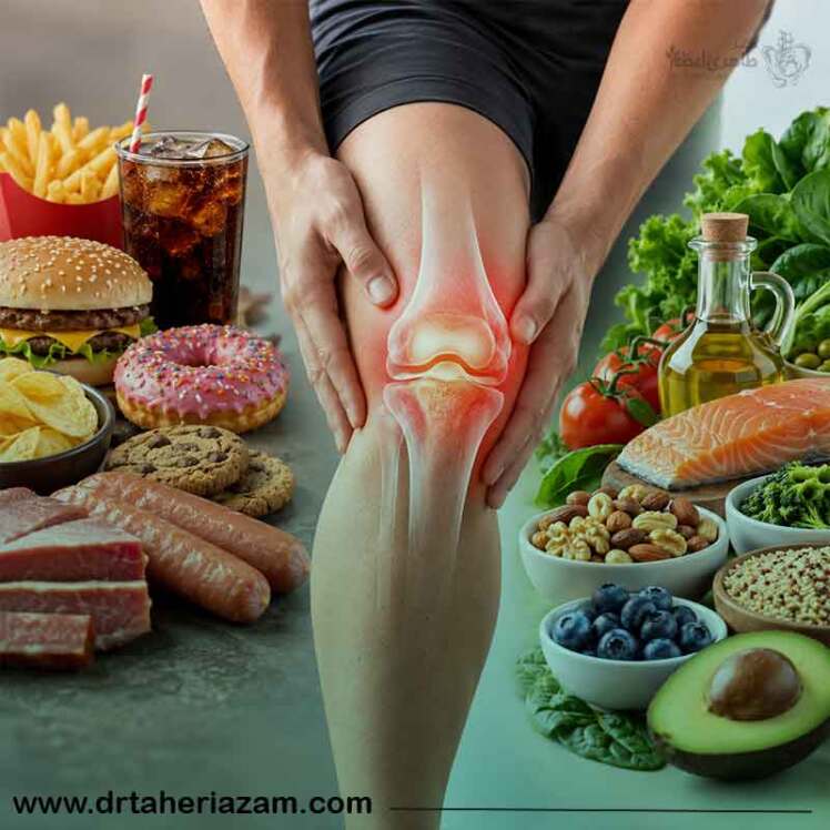غذاهای مضر برای آرتروز زانو