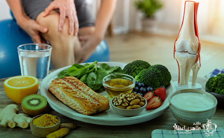 رژیم غذایی مناسب برای بهبود دامنه حرکتی بعد از تعویض مفصل زانو