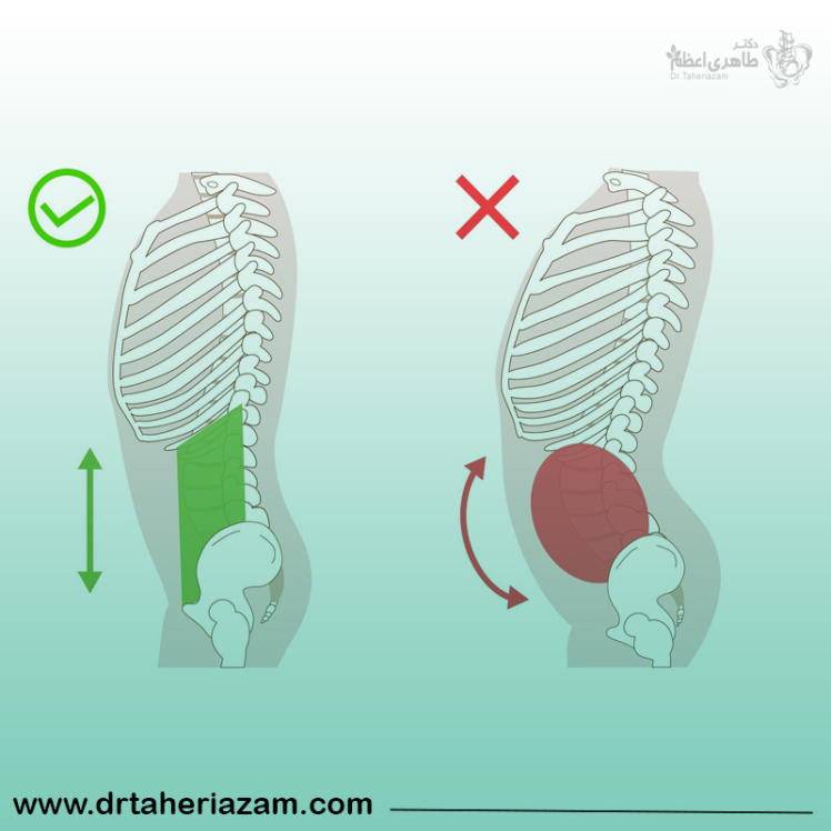 چرخش لگن؛ علل و علائم + نحوه درمان