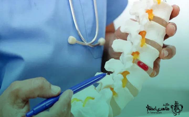 درمان دیسک کمر